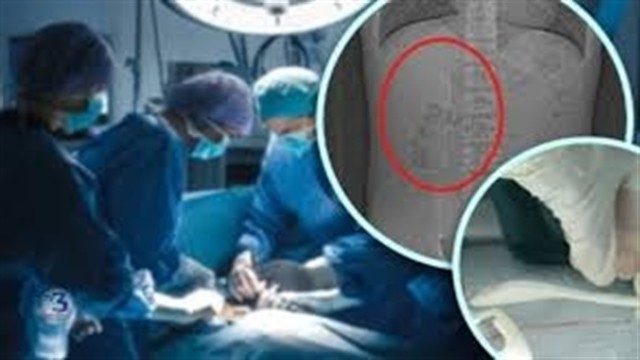 নেশার ঘোরে চামচ গিলে ফেললেন যুবক!